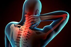 Gimdos kaklelio osteochondrozė